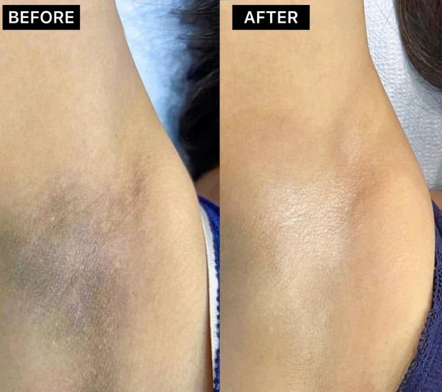 ✅Korean Whitening Scrub Gel 350ml