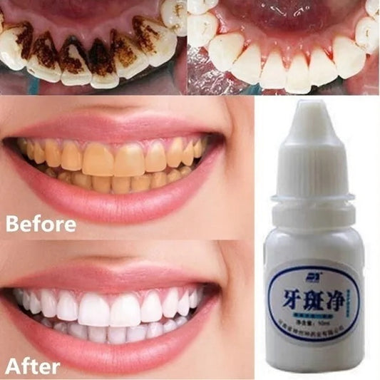 ✅Teeth Whitening Kit (100% Guarantee)