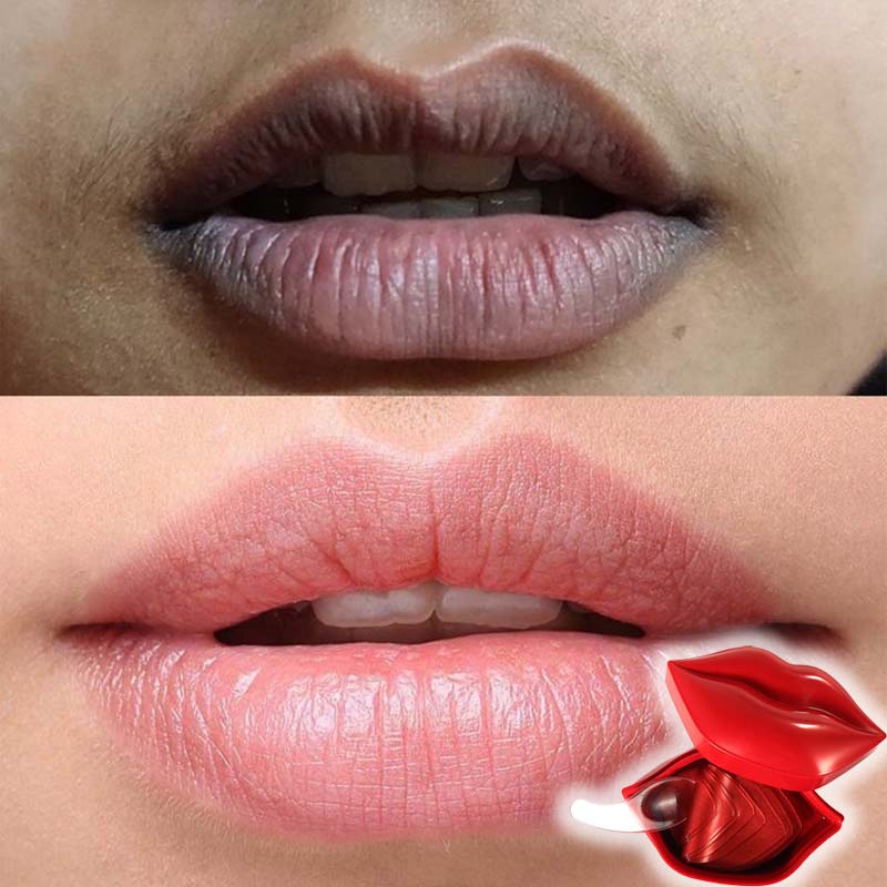 ✅कालो ओठलाई सेतो बनाउने Lip Mask( 100 % Cash back Guarantee)